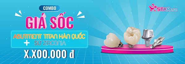 Gửi sứ giảm giá sốc